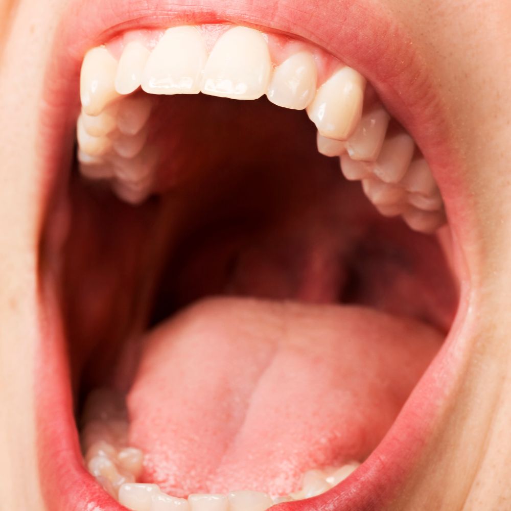 sensoral hilft bei der remineralisierung der zähne durch mundtrockenheit