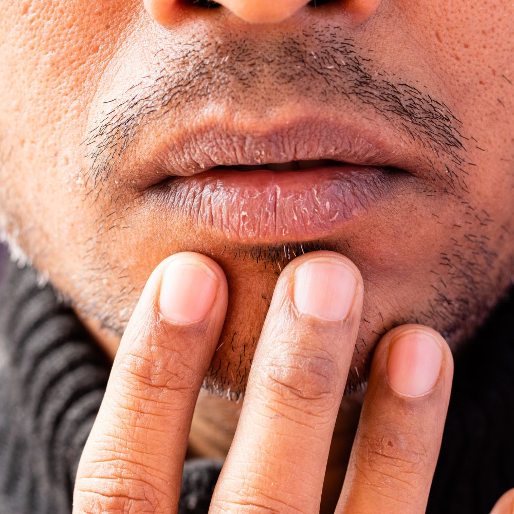 Selbsttest: leidest du an starker Mundtrockenheit?