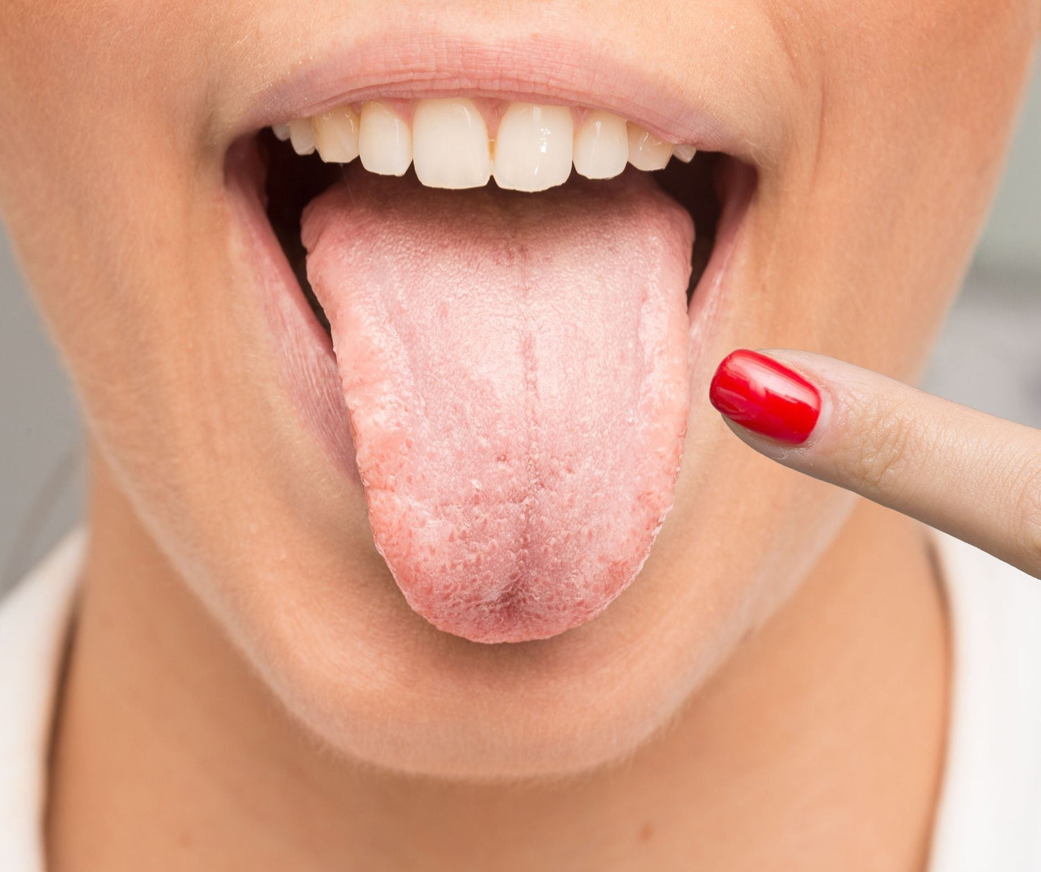 Zungenreinigung - wichtig bei Mundtrockenheit