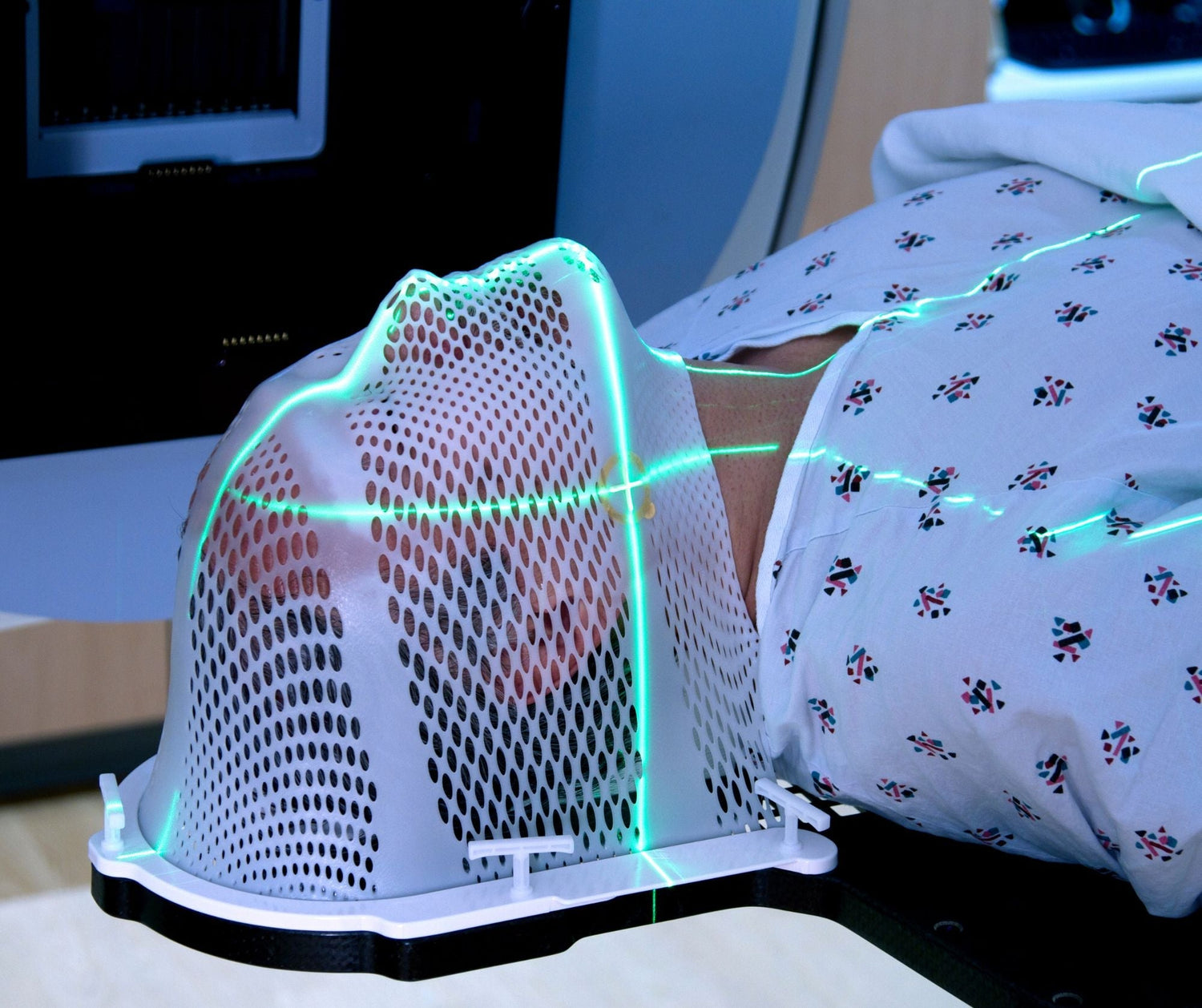 Eine Radiotherapie kann die Schleimhäute stark belasten, besonders im Mund- und Rachenbereich.