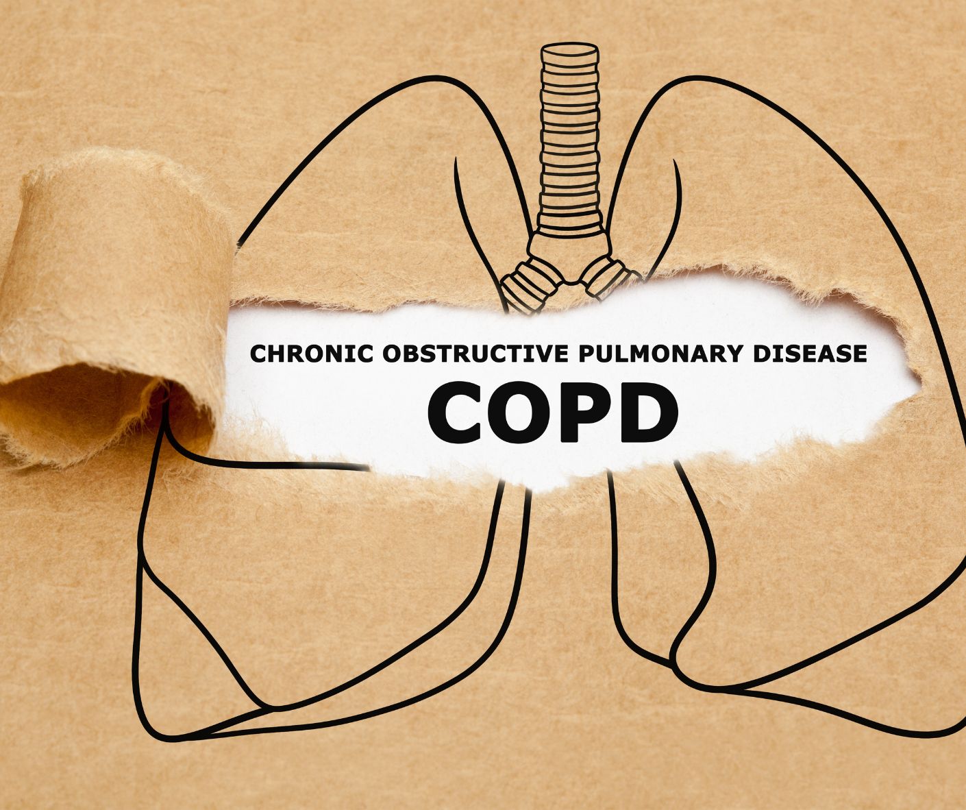 Bei COPD entsteht Mundtrockenheit häufig durch mehrere Faktoren gleichzeitig. 